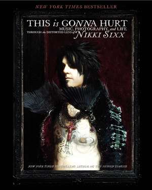 This Is Gonna Hurt: Music, Photography and Life Through the Distorted Lens of Nikki Sixx de Nikki Sixx