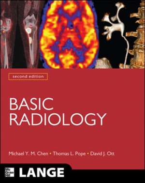 Basic Radiology, Second Edition de Michael Chen