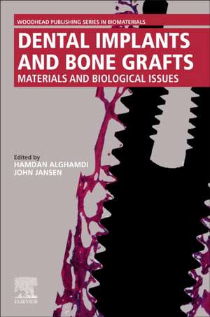 Dental Implants and Bone Grafts: Materials and Biological Issues de Hamdan Alghamdi