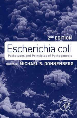 Escherichia coli: Pathotypes and Principles of Pathogenesis de Michael Donnenberg