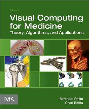 Visual Computing for Medicine: Theory, Algorithms, and Applications de Bernhard Preim