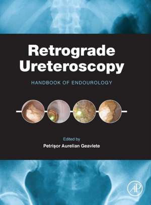 Retrograde Ureteroscopy: Handbook of Endourology de Petrisor Aurelian Geavlete