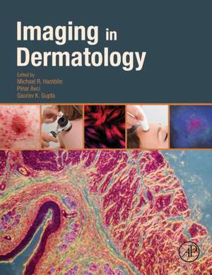 Imaging in Dermatology de Michael R. Hamblin