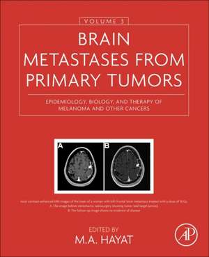 Brain Metastases from Primary Tumors, Volume 3: Epidemiology, Biology, and Therapy of Melanoma and Other Cancers de M. A. Hayat