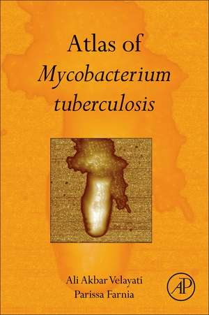 Atlas of Mycobacterium Tuberculosis de Ali Akbar Velayati