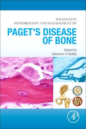 Advances in Pathobiology and Management of Paget’s Disease of Bone de Sakamuri V. Reddy