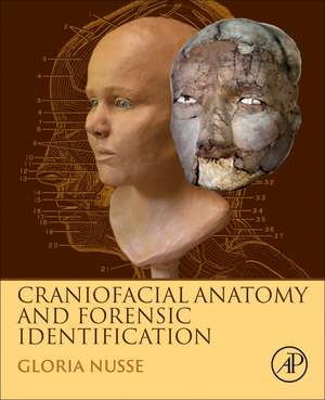 Craniofacial Anatomy and Forensic Identification de Gloria Nusse