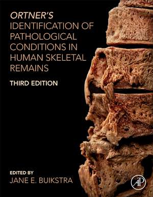 Ortner's Identification of Pathological Conditions in Human Skeletal Remains de Jane E. Buikstra