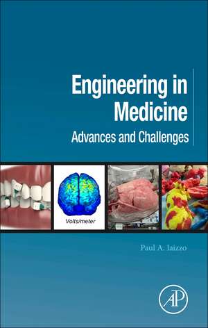 Engineering in Medicine: Advances and Challenges de Paul A. Iaizzo