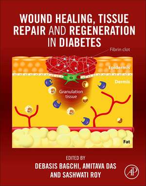 Wound Healing, Tissue Repair, and Regeneration in Diabetes de Debasis Bagchi