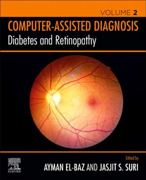 Diabetes and Retinopathy de Ayman S. El-Baz