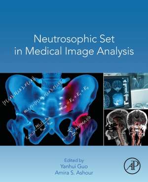 Neutrosophic Set in Medical Image Analysis de Yanhui Guo