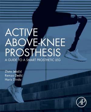 Active Above-Knee Prosthesis: A Guide to a Smart Prosthetic Leg de Zlata Jelacic