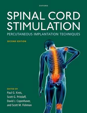 Spinal Cord Stimulation: Percutaneous Implantation Techniques de Paul G. Kreis