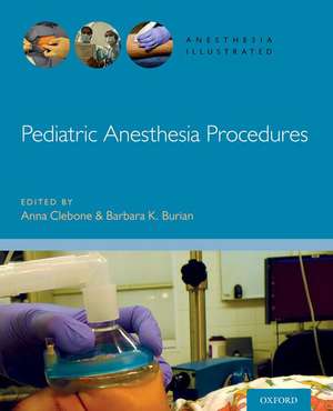 Pediatric Anesthesia Procedures de Anna Clebone