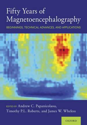 Fifty Years of Magnetoencephalography: Beginnings, Technical Advances, and Applications de Andrew C. Papanicolaou