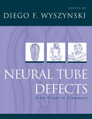 Neural Tube Defects: From origin to treatment de Diego F. Wyszynski