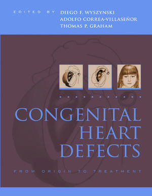 Congenital Heart Defects: From Origin to Treatment de Diego Wyszynski