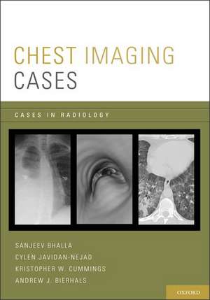 Chest Imaging Cases de Sanjeev Bhalla