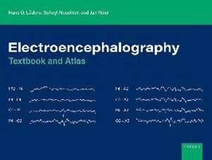 Electroencephalography: Textbook and Atlas de Hans O. Lüders