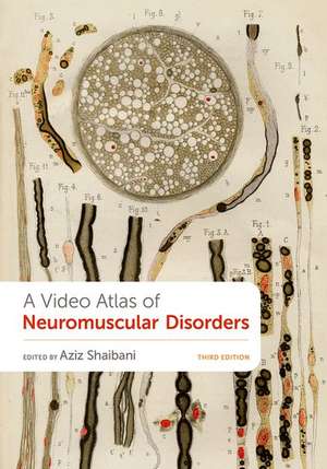 A Video Atlas of Neuromuscular Disorders de Aziz Shaibani