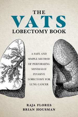 The VATS Lobectomy Book: A Safe and Simple Method of Performing Minimally Invasive Lobectomy for Lung Cancer de Brian Housman