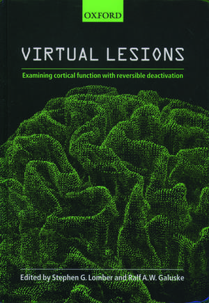 Virtual Lesions: Examining Cortical Function with Reversible Deactivation de Stephen G. Lomber