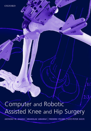 Computer and Robotic Assisted Hip and Knee Surgery de Anthony DiGioia