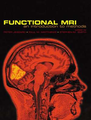 Functional Magnetic Resonance Imaging: An Introduction to Methods de Peter Jezzard