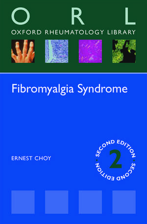 Fibromyalgia Syndrome de Ernest Choy