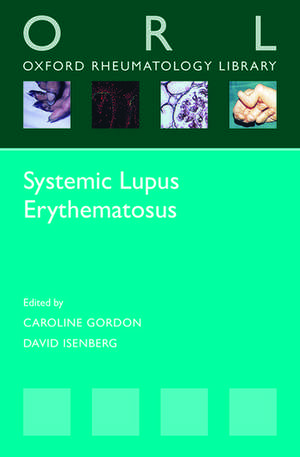 Systemic Lupus Erythematosus de Caroline Gordon