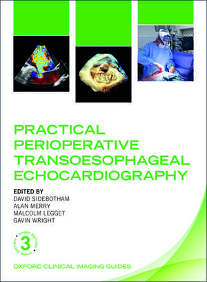 Practical Perioperative Transoesophageal Echocardiography de David Sidebotham