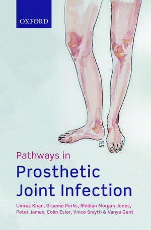 Pathways in Prosthetic Joint Infection de Umraz Khan