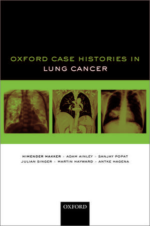 Oxford Case Histories in Lung Cancer de Himender K. Makker