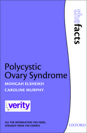 Polycystic Ovary Syndrome de Mohgah Elsheikh