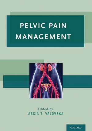 Pelvic Pain Management de Assia T. Valovska