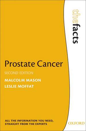 Prostate Cancer de Malcolm Mason