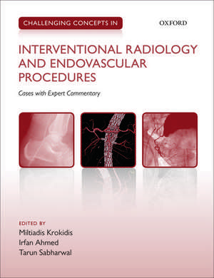 Challenging Concepts in Interventional Radiology de Miltiadis Krokidis