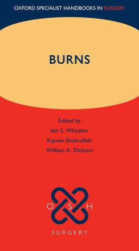 Burns de Iain S. Whitaker