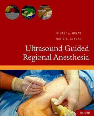 Ultrasound Guided Regional Anesthesia de Stuart A. Grant