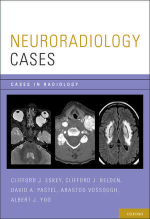 Neuroradiology Cases de Clifford J. Eskey