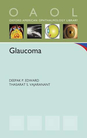 Glaucoma de Deepak P. Edward