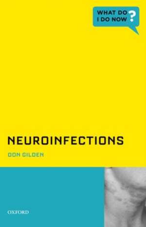 Neuroinfections de Don Gilden