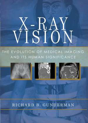 X-Ray Vision: The Evolution of Medical Imaging and Its Human Significance de Richard B. Gunderman