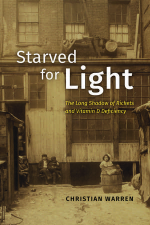 Starved for Light: The Long Shadow of Rickets and Vitamin D Deficiency de Christian Warren