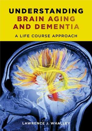 Understanding Brain Aging and Dementia – A Life Course Approach de Lawrence Whalley