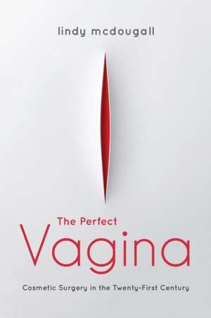 The Perfect Vagina – Cosmetic Surgery in the Twenty–First Century de Lindy Mcdougall