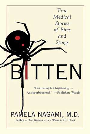 Bitten: True Medical Stories of Bites and Stings de Pamela Nagami