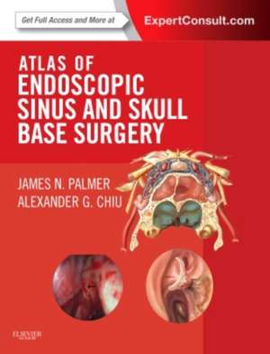 Atlas of Endoscopic Sinus and Skull Base Surgery Expert Consult - Online and Print: Palmer Atlas de chirurgie endoscopică de James N. Palmer