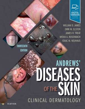 Andrews' Diseases of the Skin: Clinical Dermatology de William D. James